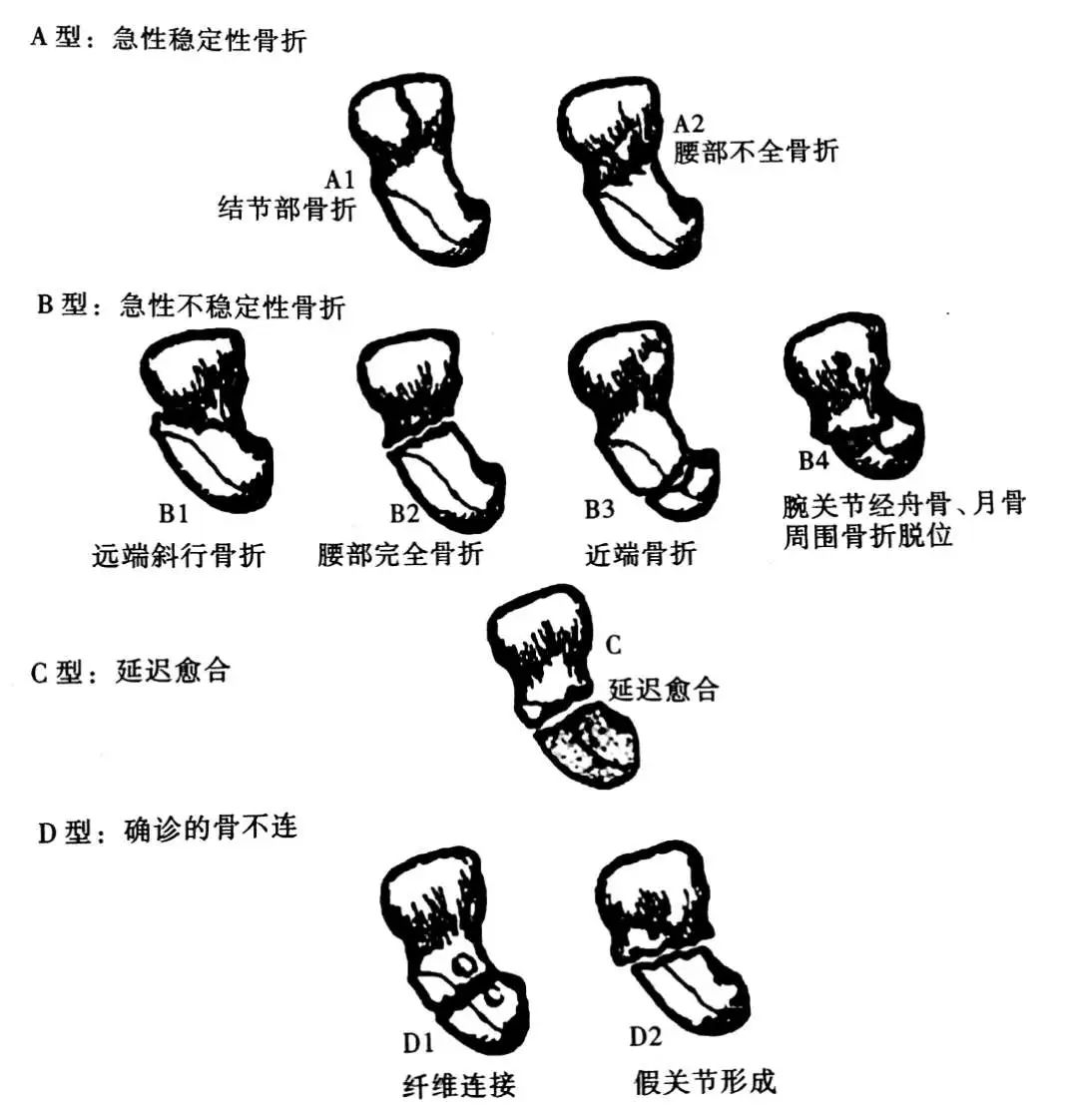 图1-1-36 手骨-人体解剖学与组织生理病理学-医学