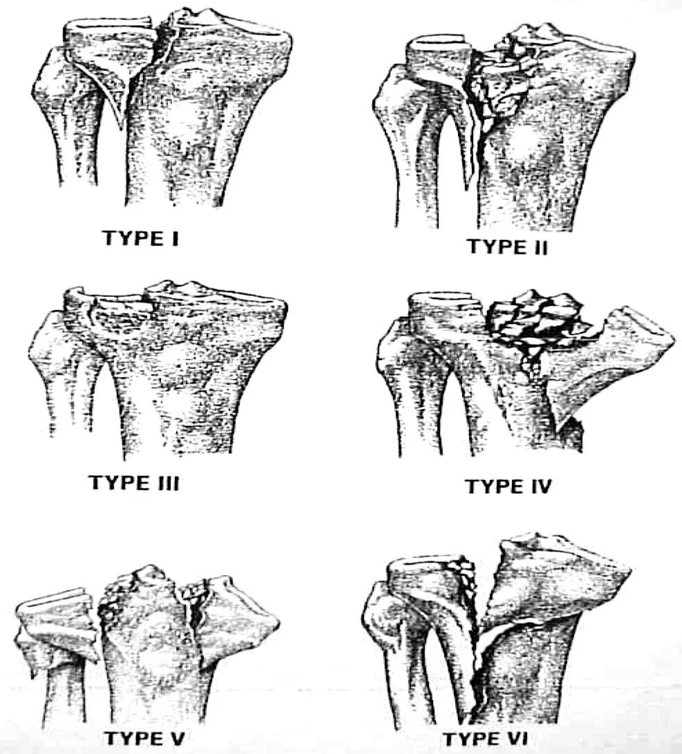 002,图片来源:Thomas et al. (2009), Figure 2.