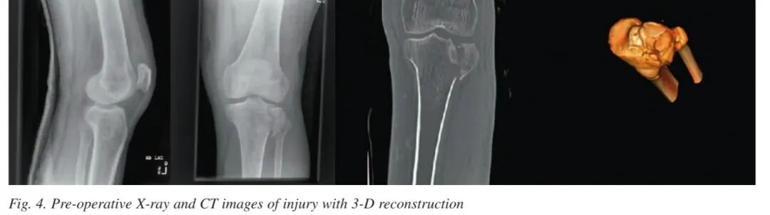 004,图片来源:Thomas et al. (2009), Figure 4.