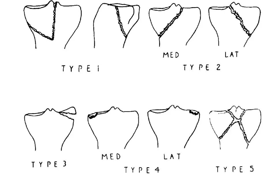 003,图片来源:Thomas et al. (2009), Figure 3.