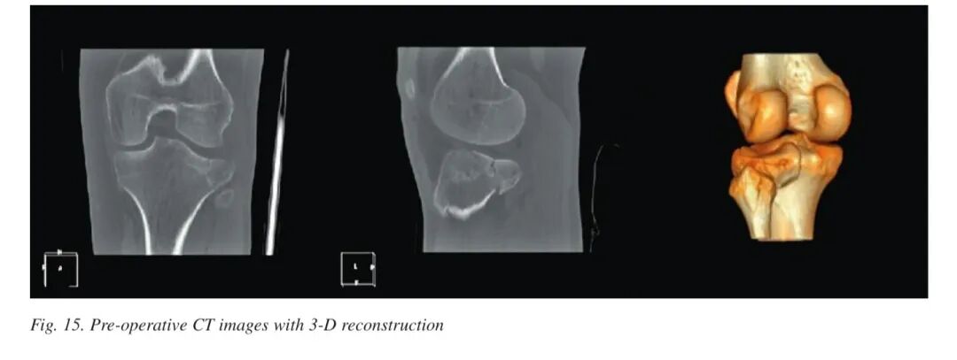 015,图片来源:Thomas et al. (2009), Figure 15.