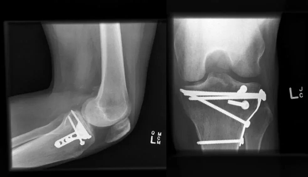 018,图片来源:Thomas et al. (2009), Figure 18.
