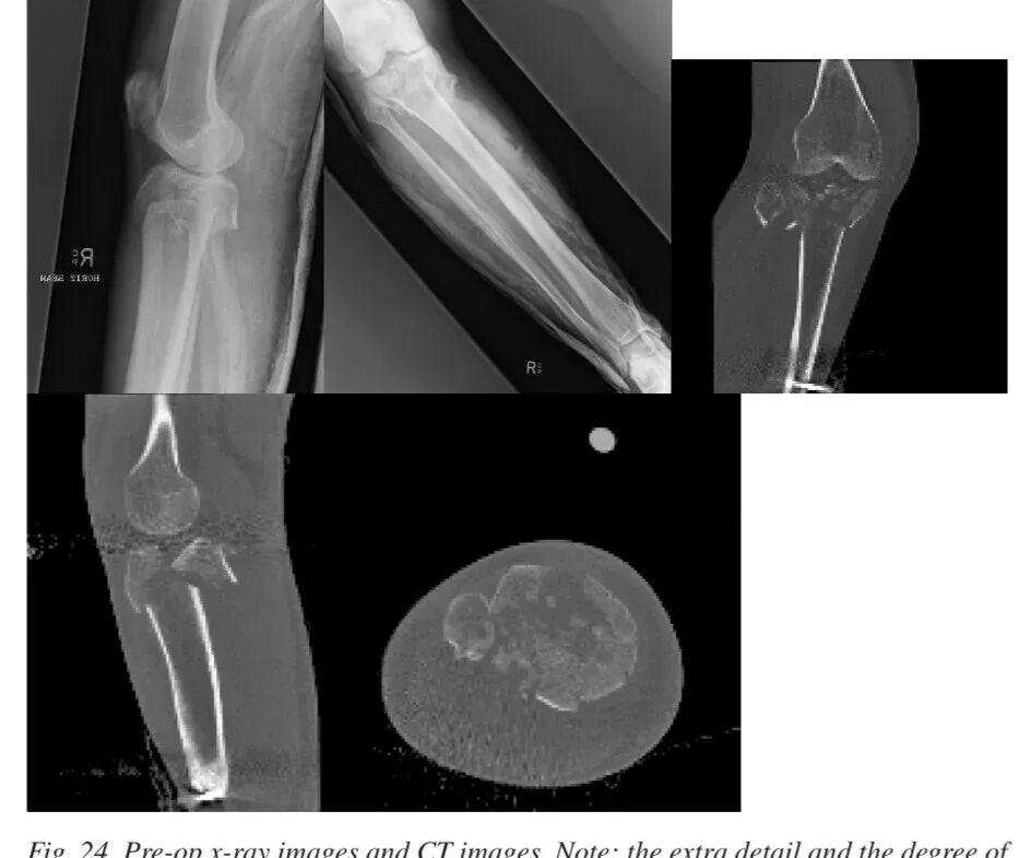 024,图片来源:Thomas et al. (2009), Figure 24.