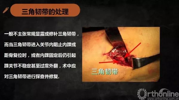 微信圖片_20180207142709.jpg