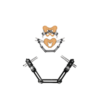 CareFix unilaternal Pelvic external Fixator,Pelvic Fixation