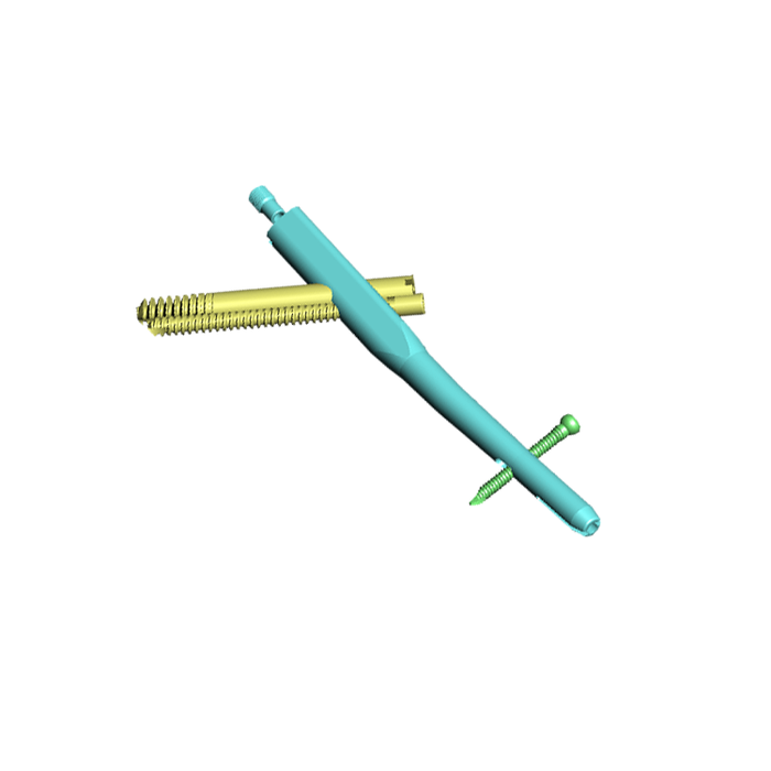 Proximal Femoral Interlocking Nails -3.png