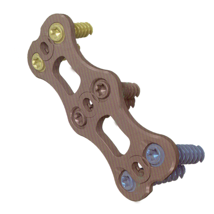 Anterior Cervical Plate System-2.png