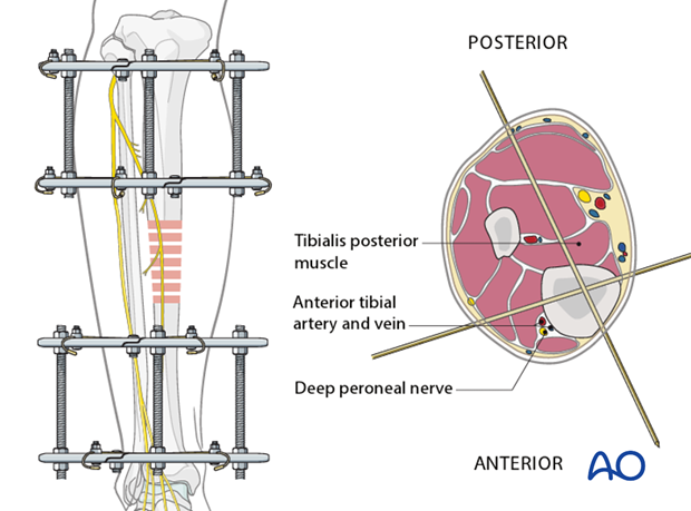 Patient positioning