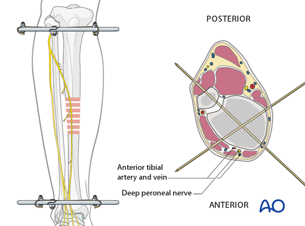 Patient positioning