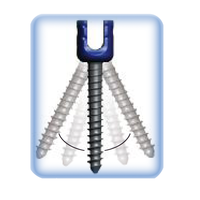椎弓根釘Posterior Thoracolumber Screw-Rod System.png