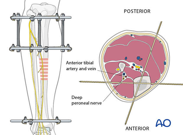 Patient positioning