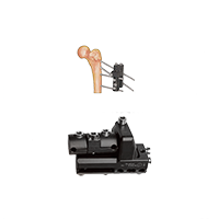 CareFix unilaternal Pertrochanteric external Fixator