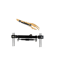 CareFix unilaternal Dynamic Wrist external Fixator