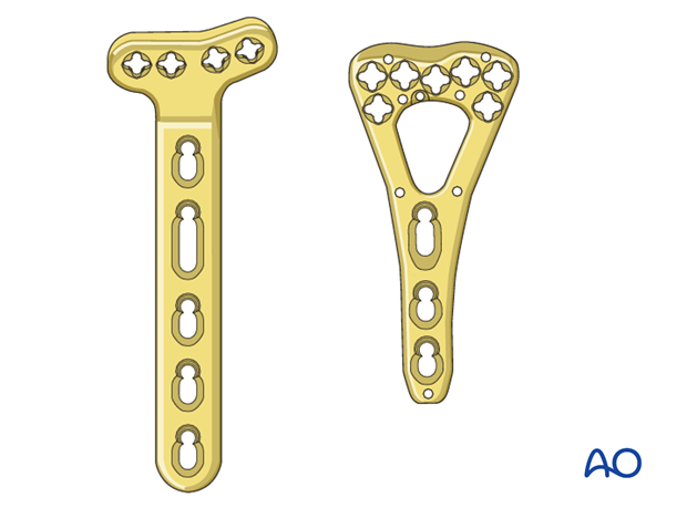 orif palmar plate