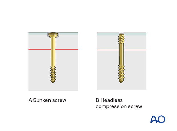 Screw types