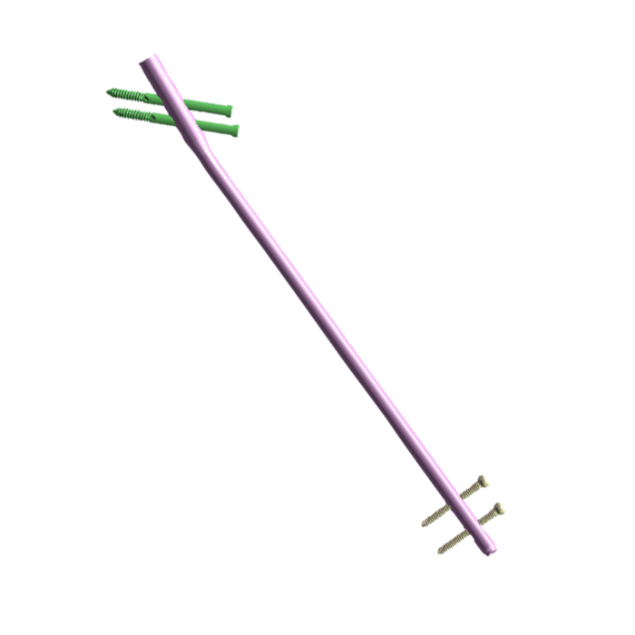 Femoral Interlocking Nail.png