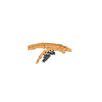 CareFix unilaternal Articulated Minirail external Fixtion