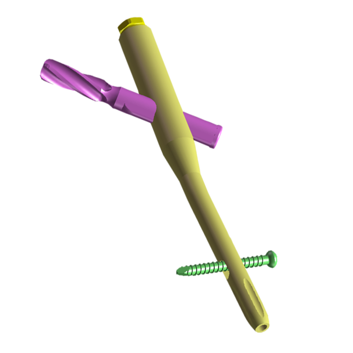 Intertrochanteric Antegrade Nails -1 (2).png