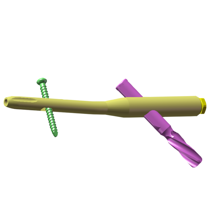 Intertrochanteric Antegrade Nails -1 (1).png