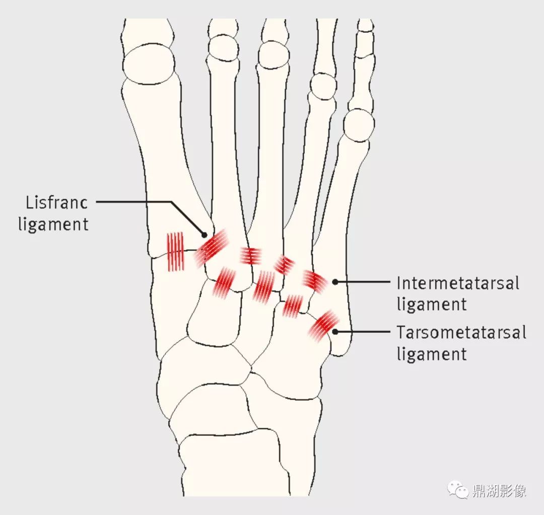 (3)检查者一手固定足跟,另一只手跖屈和背伸跖骨头,观察跖跗关节是否