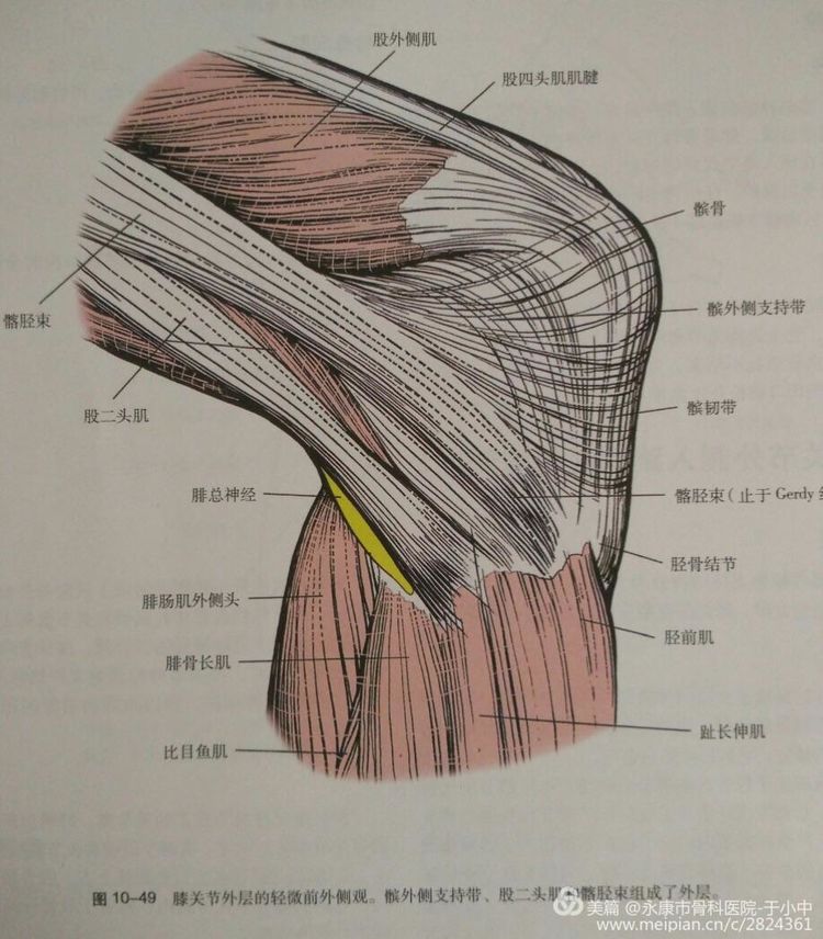 股骨外髁hoffa骨折的诊断与手术技巧
