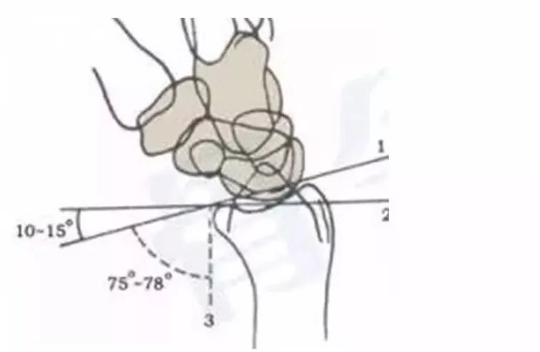 桡骨掌倾角teardrop角系反应桡骨远端关节面掌侧边缘背伸情况,即侧位