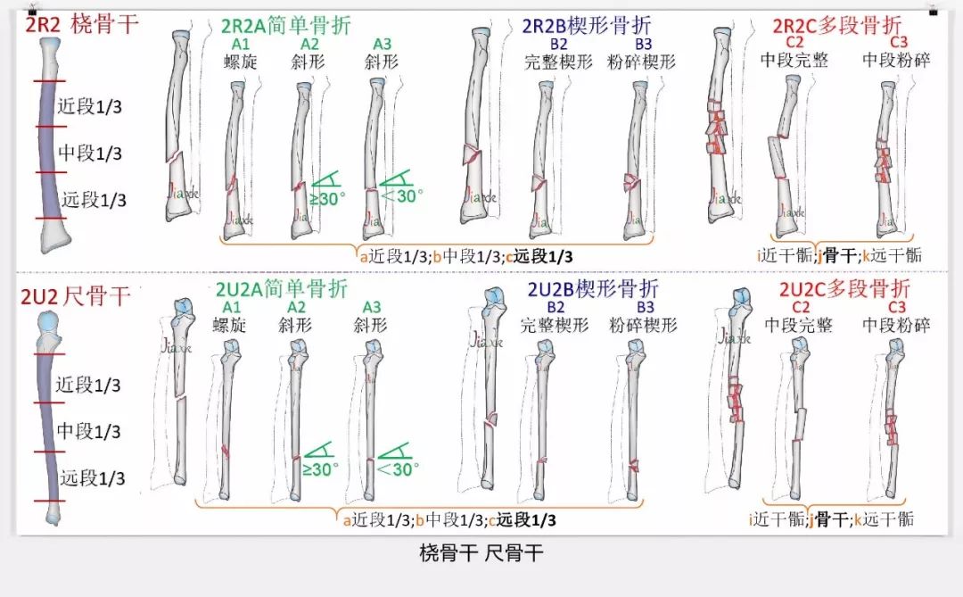 早读 | 值得收藏!最全的ao骨折分型图谱