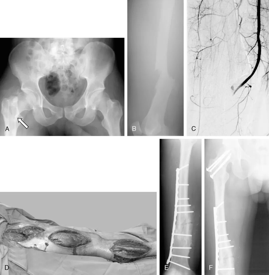 003,图片来源：Russell et al. (2002), Figure 3.