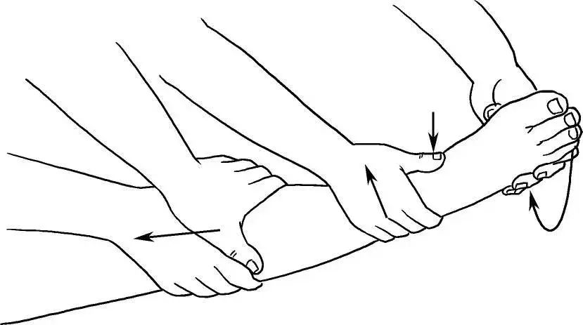 足位于背伸外翻位图20 石膏固定于背伸外翻位图21 复位前踝关节正侧位