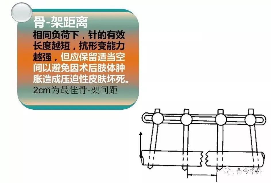 医用石膏夹板怎么用最全汇总 ｜ 4种骨科常用外固定_https://www.jmylbn.com_新闻资讯_第36张