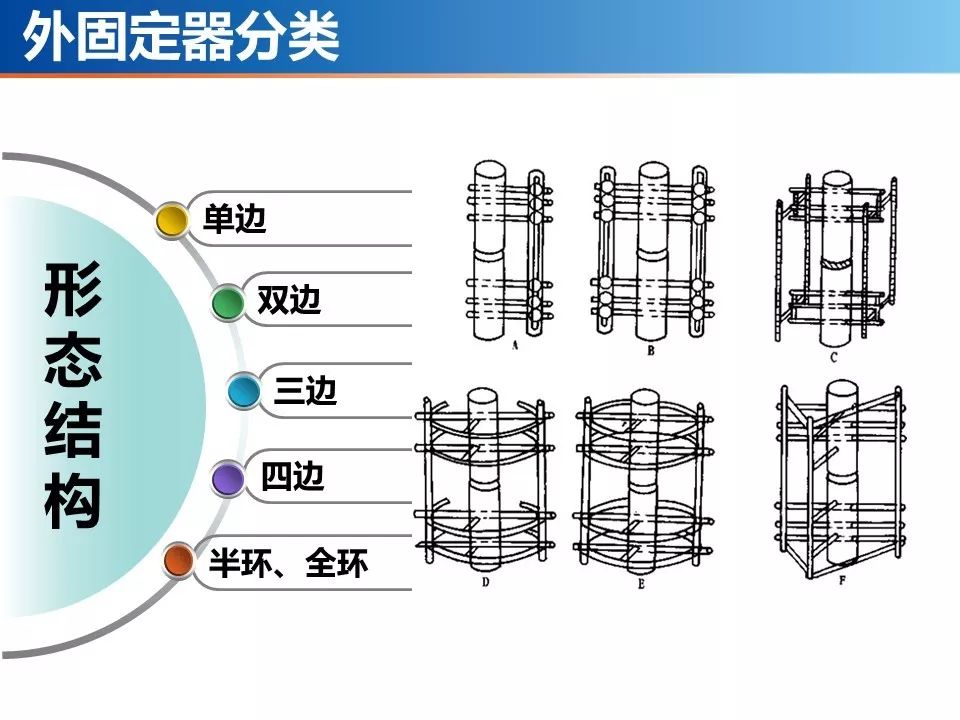 医用石膏夹板怎么用最全汇总 ｜ 4种骨科常用外固定_https://www.jmylbn.com_新闻资讯_第30张