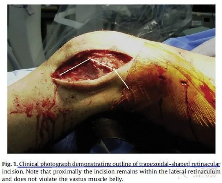 上海开为医药科技有限公司--创伤,肢体矫形技术