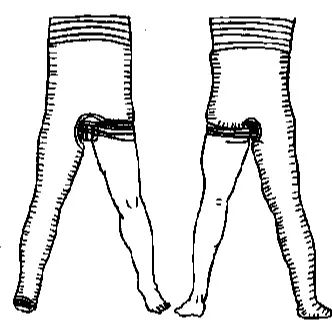 医用石膏夹板怎么用最全汇总 ｜ 4种骨科常用外固定_https://www.jmylbn.com_新闻资讯_第11张