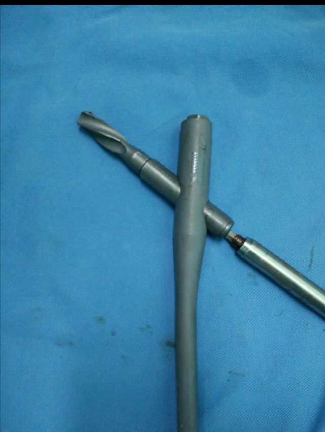 困难pfna取出方法 - 上海开为医药科技有限公司--创伤,肢体矫形技术