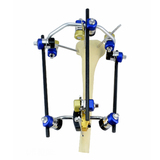 股骨近端标准构型