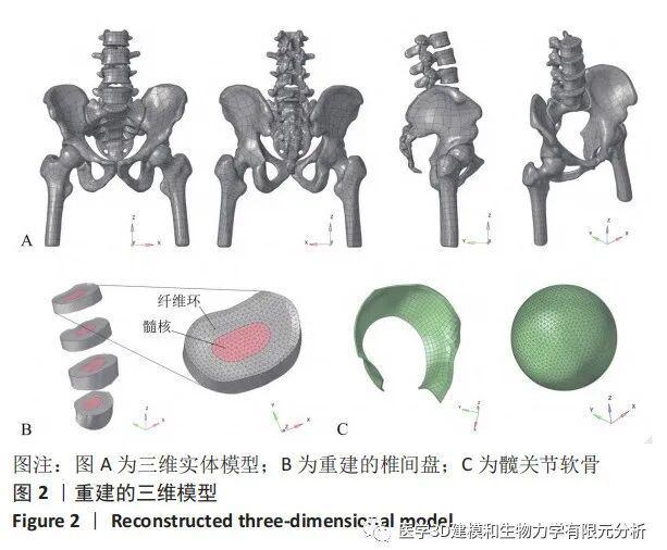 腰椎- 骨盆- 髋关节有限元模型建立及生物力学分析- 上海开为医药科技