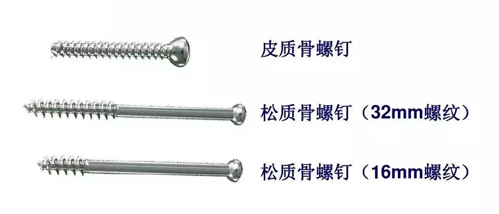 骨折内固定材料的种类 | 骨科基础
