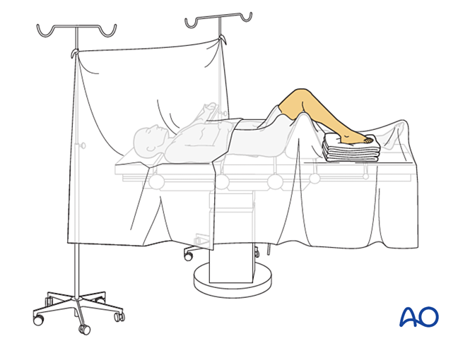 关节钳怎么用近节拇趾关节外骨折的钢板固定（AO指南）_https://www.jmylbn.com_新闻资讯_第4张