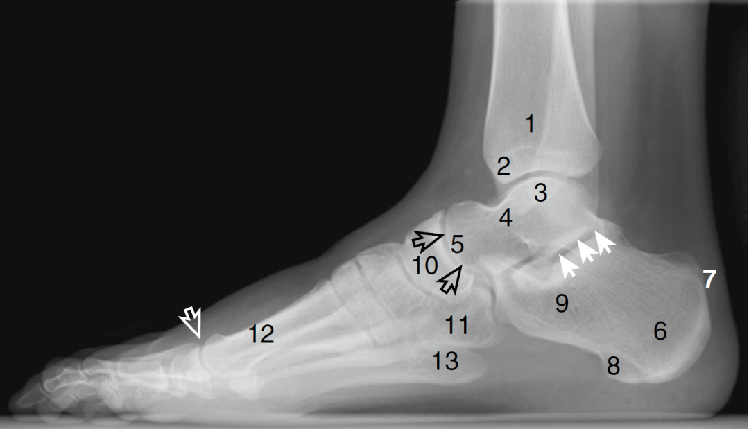踝关节解剖图x线图片