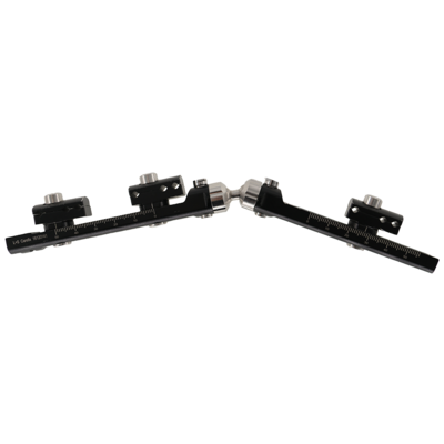 桡骨远端 孟氏骨折型