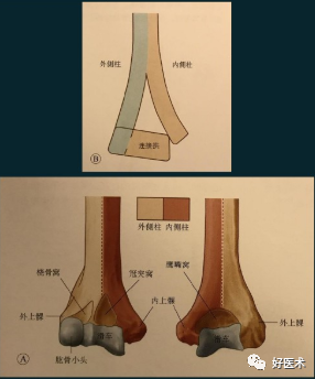 早讀| 做好肱骨遠端骨折手術,從熟悉解剖,分型及手術入路開始!