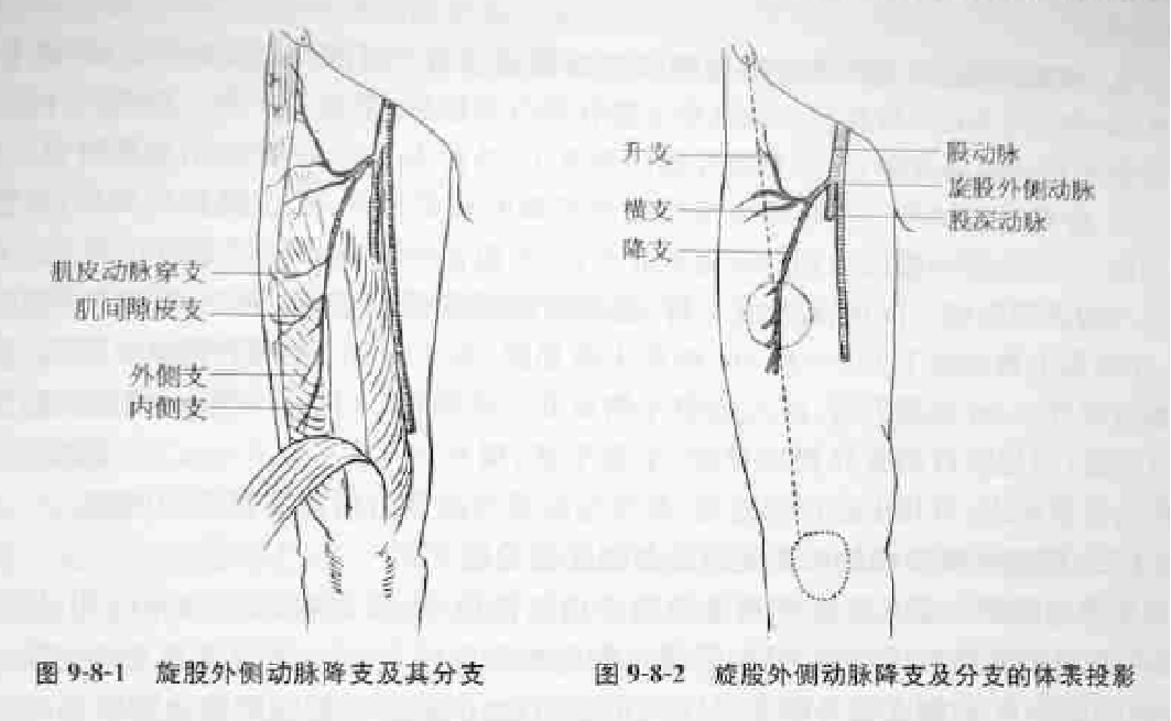 骨科精读 | 手术技巧:股前外侧皮瓣的临床应用! - 上海开为医药科技有限公司--创伤、肢体矫形技术解决方案的专业服务商