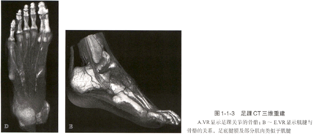 足踝关节解剖丨骨骼、关节、软组织 - 上海开为医药科技有限公司--创伤、肢体矫形技术解决方案的专业服务商