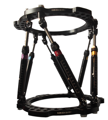 泰勒多功能外固定支架4