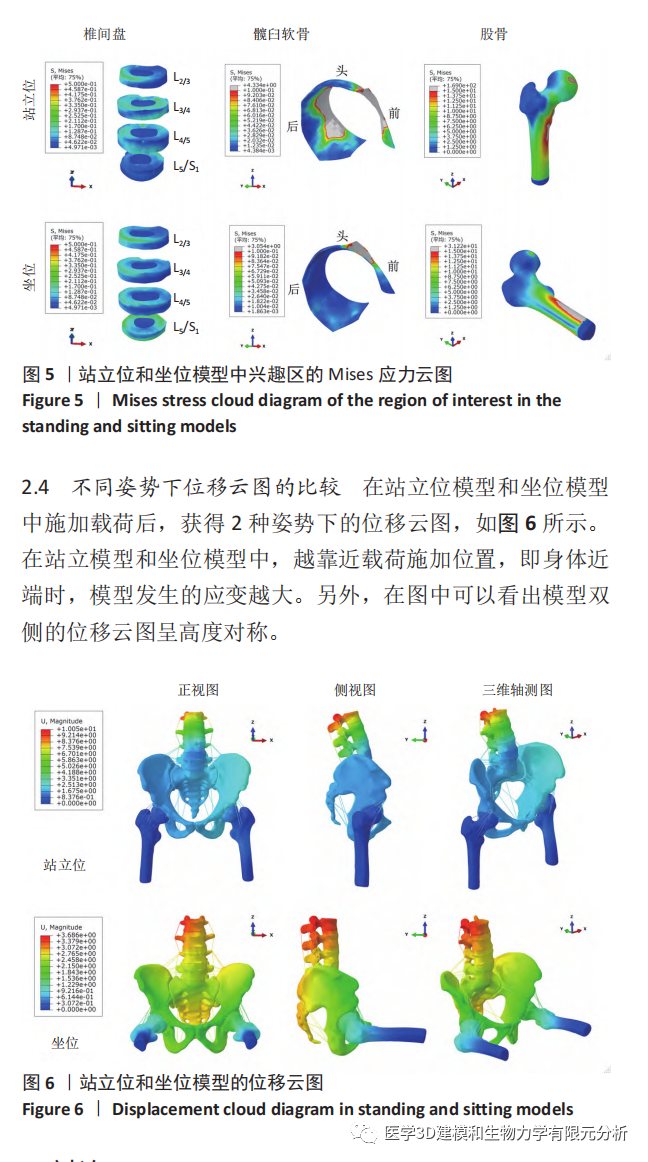 腰椎- 骨盆- 髋关节有限元模型建立及生物力学分析- 上海开为医药科技